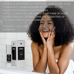 D´ Bullon Serum Facial Concentrado Especial Anti-acné Directo, Acción Intensiva. Vegano. Combate el acne y granos. Con Aloe Vera. Eliminar rápido el acné - 30 ml